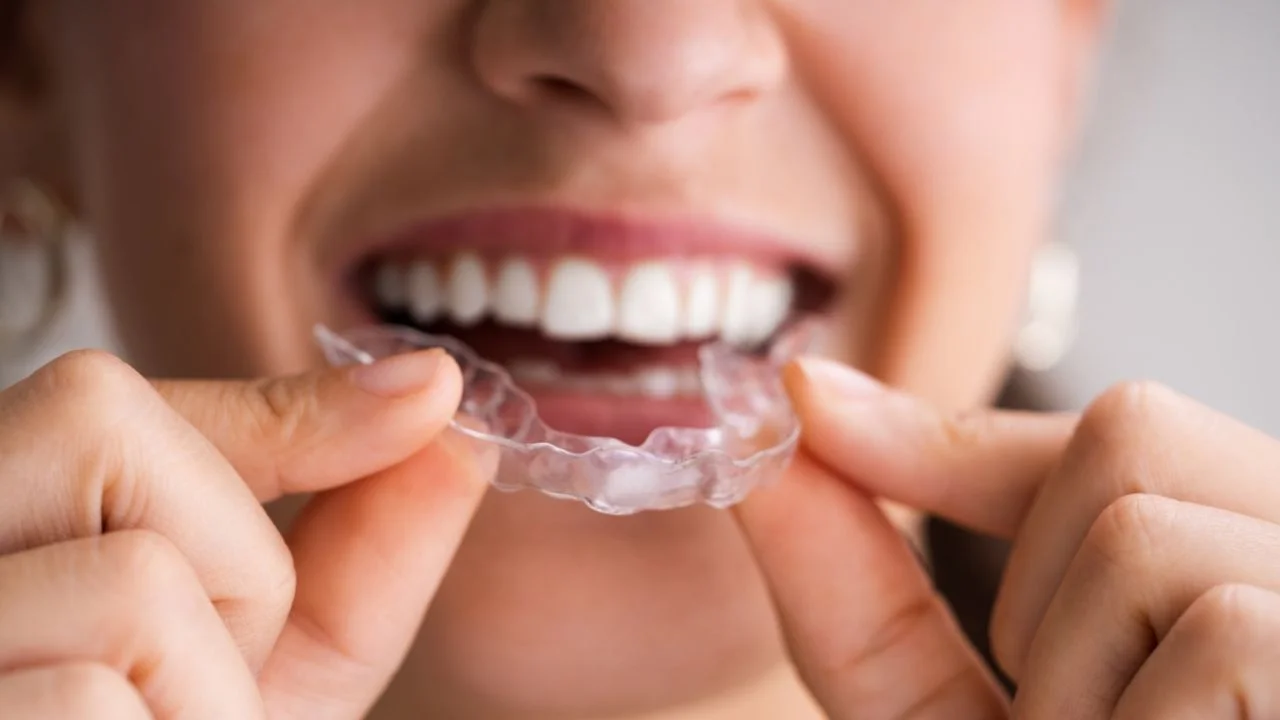 Invisalign for Adults in Turkey: Navigating Treatment Costs