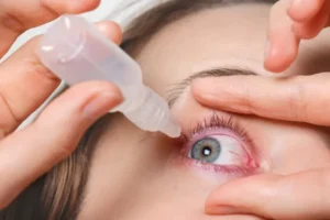 LASIK Photophobia: Causes & Management