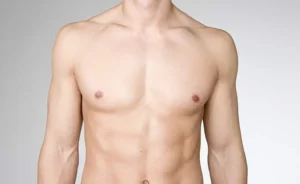 Male Chest Contouring: VASER Liposuction for Gynecomastia