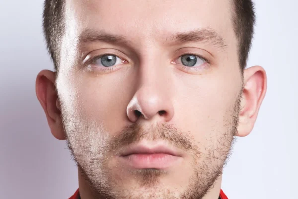 Strabismus Surgery in Turkey: Expert Surgical Insights