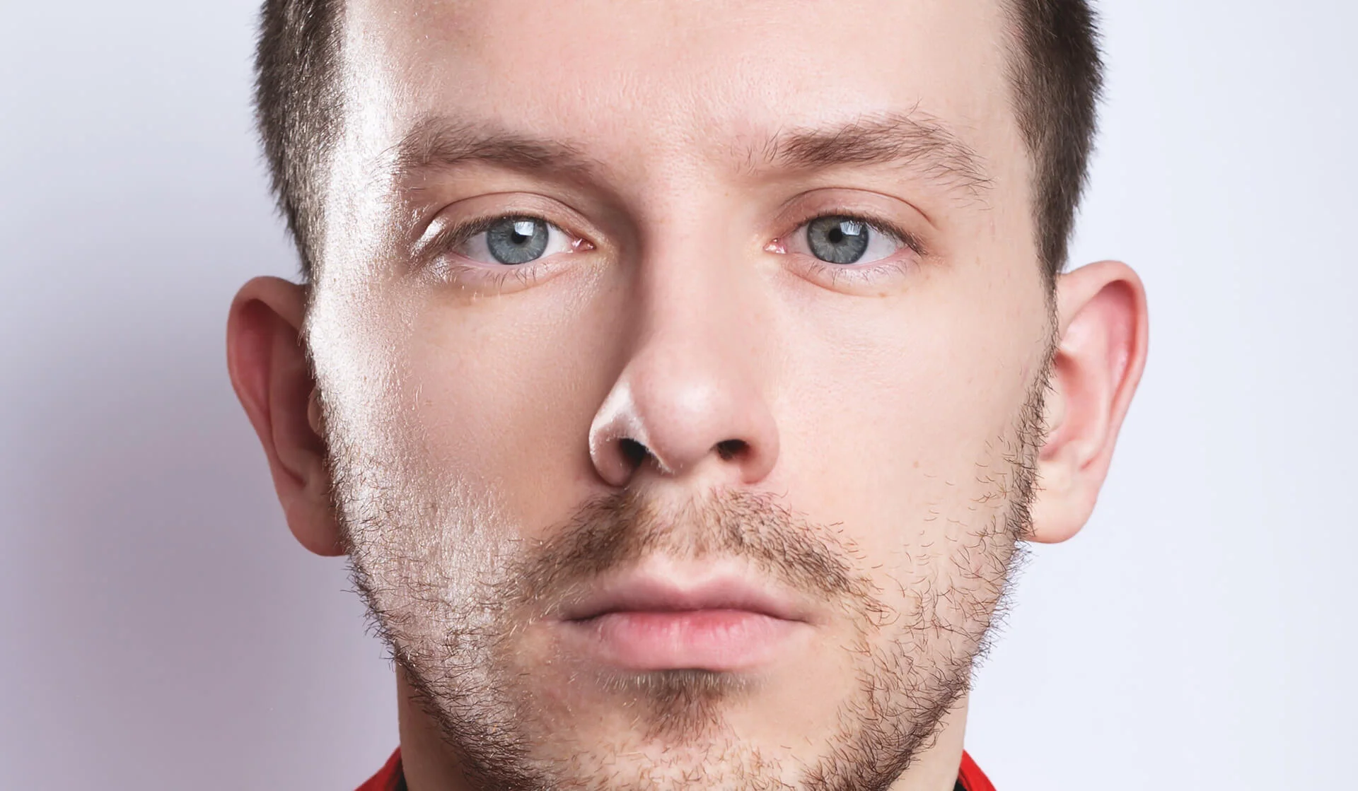 Strabismus Surgery in Turkey: Expert Surgical Insights
