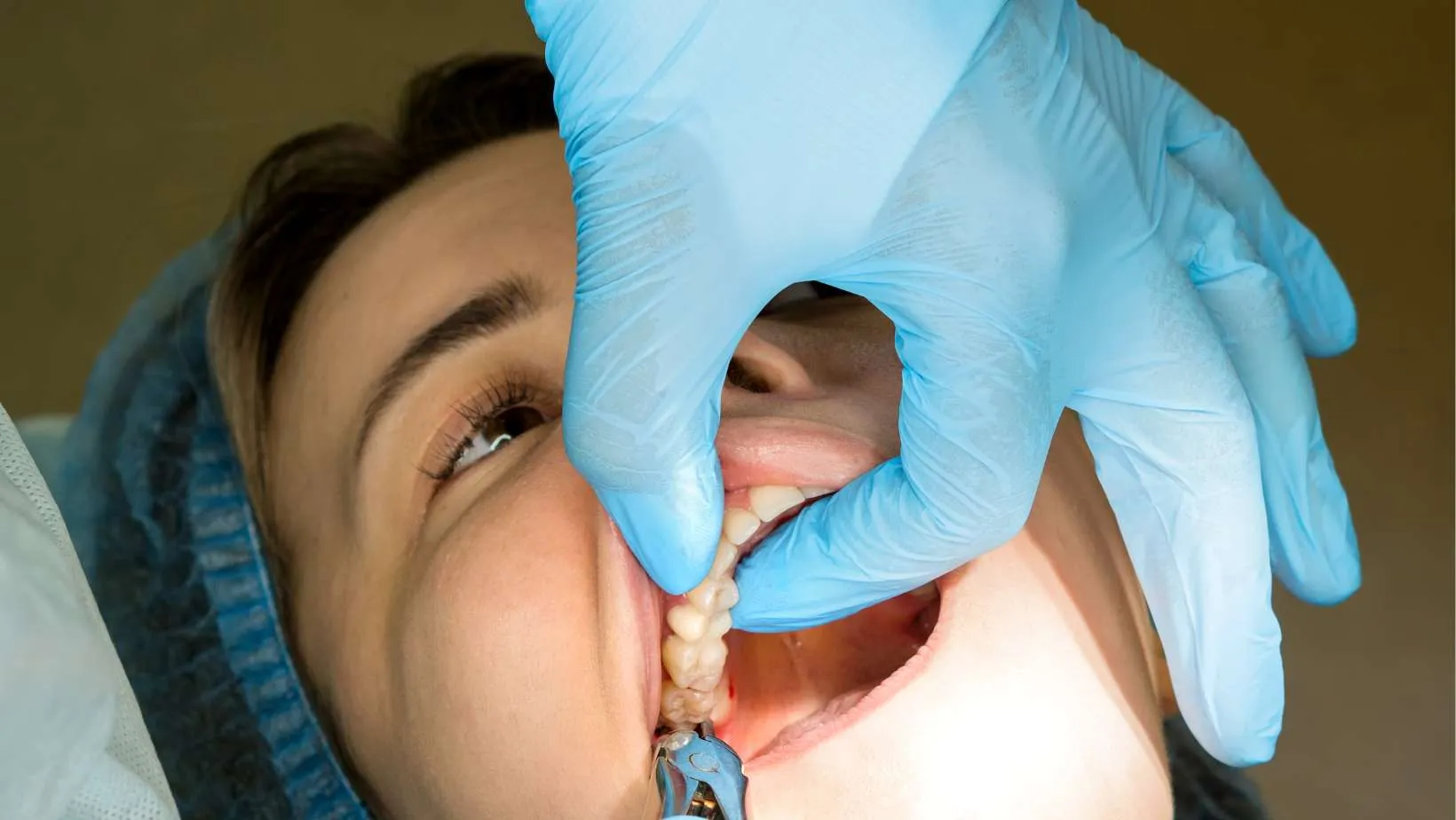 Oral Surgery Recovery: Stitch Removal Steps
