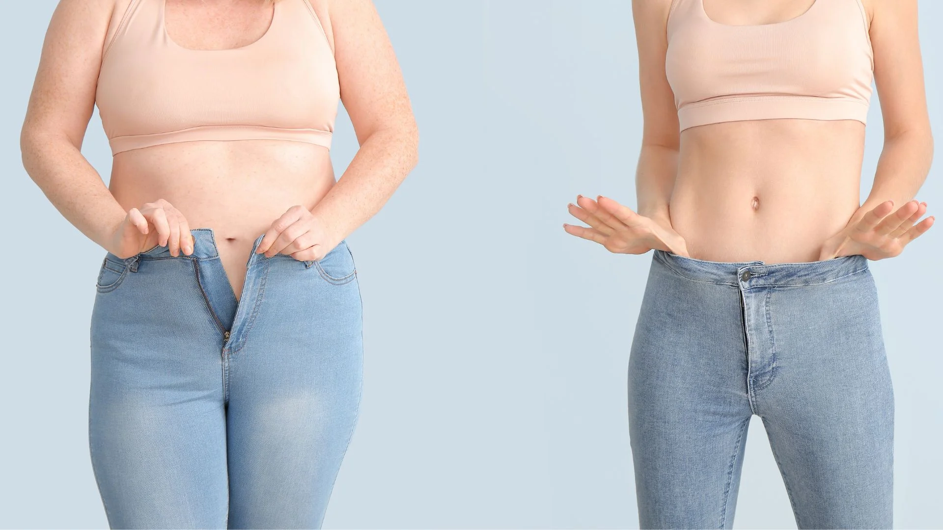 PCOS & Weight Loss: Surgical Solutions