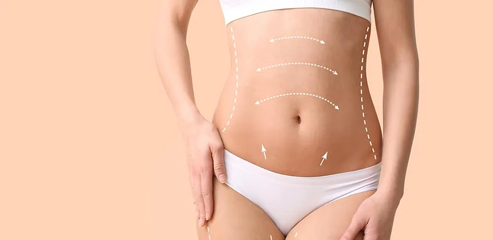 Post-Op Care: Navigating Extended Tummy Tuck Recovery