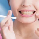 Dental Whitening: Addressing Smoker Discoloration