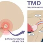 Jaw Pain Relief: Expert TMJ Disorder Treatment