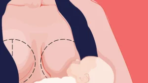 Mummy Makeover Timing: Breastfeeding & Weight Loss