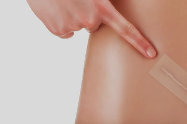 Effective Scar Care: Silicone Gel After Abdominoplasty