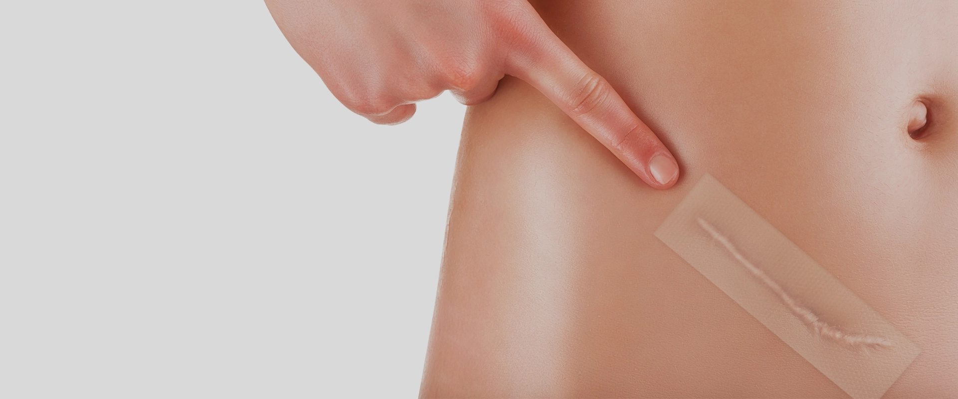 Effective Scar Care: Silicone Gel After Abdominoplasty