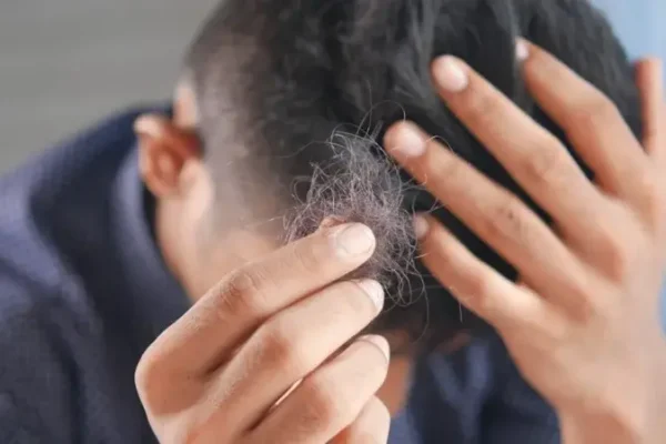 Patient Hair Loss: Prevention Strategies