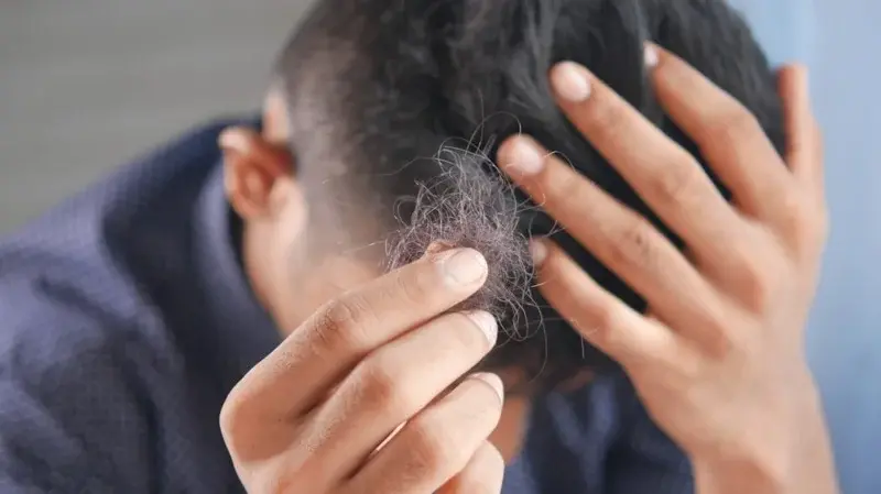 Hair Loss Prevention Strategies: Transplant Patients’ Long-Term Guide