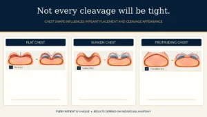 How Chest Shape Affects Breast Implant Cleavage