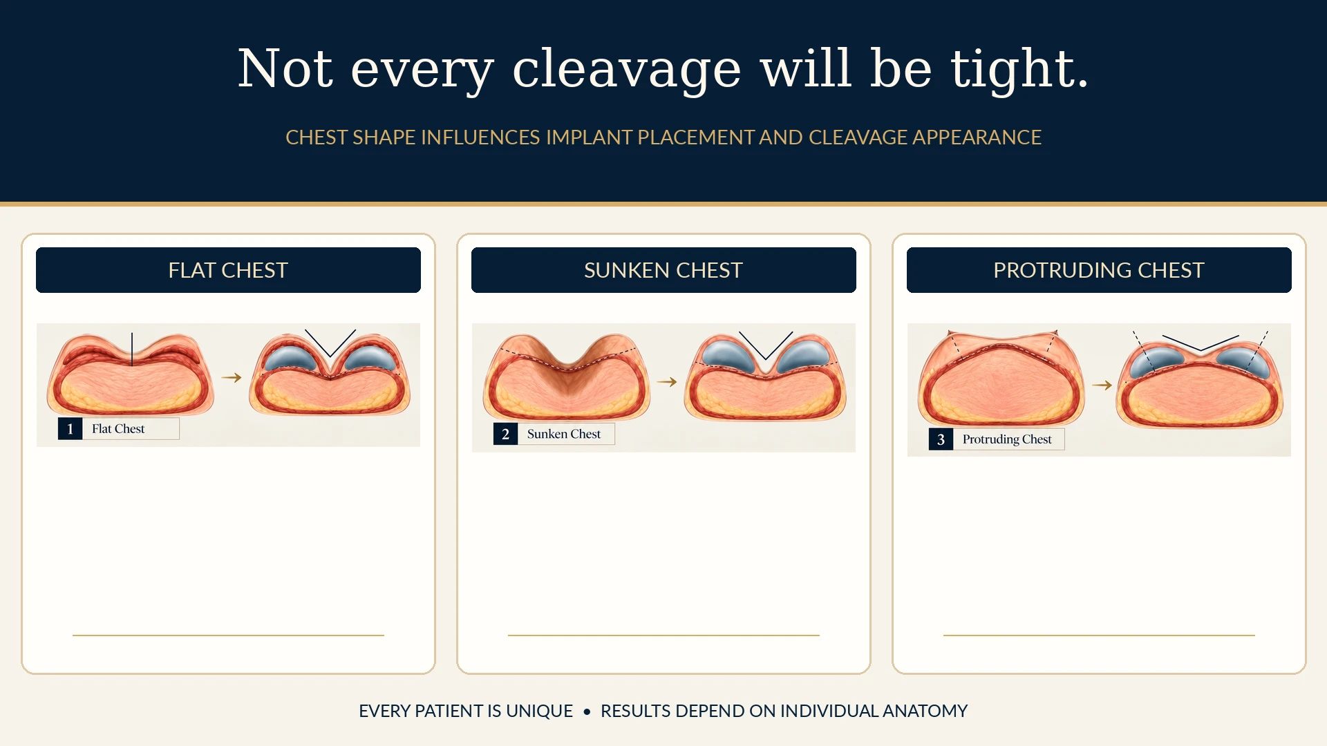 How Chest Shape Affects Breast Implant Cleavage